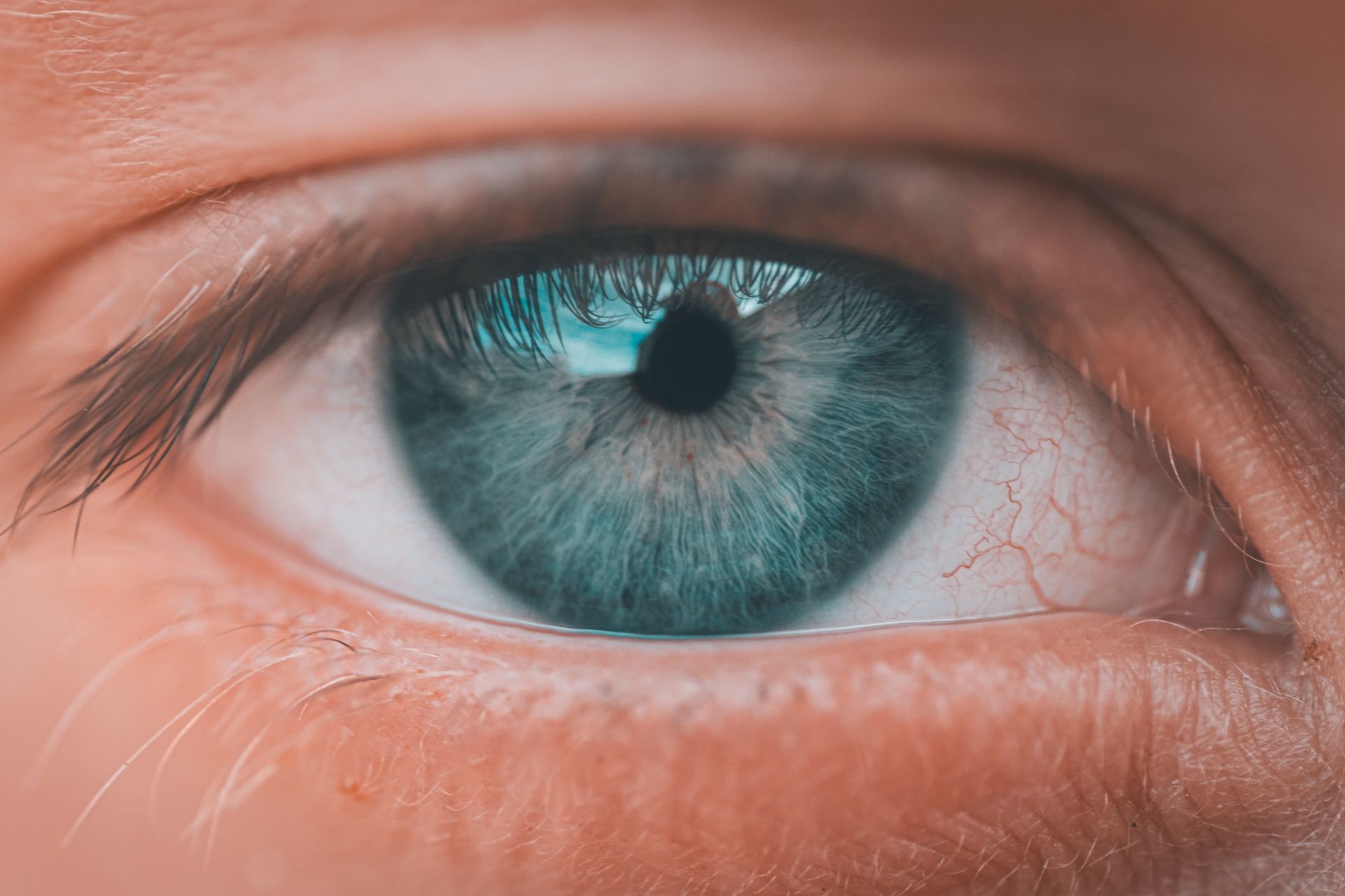 EMDR Terapisi